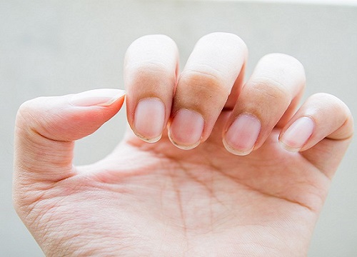 progress of green nails bacteria healing after one week (took off acrylics  from a salon that obviously wasn't hygienic). how much longer until i can  do my nails again?? : r/Nails